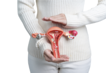 Carcinosi peritoneale, Irccs Gemelli sperimenta terapia innovativa