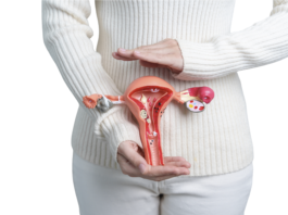 Carcinosi peritoneale, Irccs Gemelli sperimenta terapia innovativa