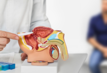 Tumore della prostata: medicina di precisione tra screening, biomarcatori e PARP-inibitori medicina di precisione nel tumore della prostata