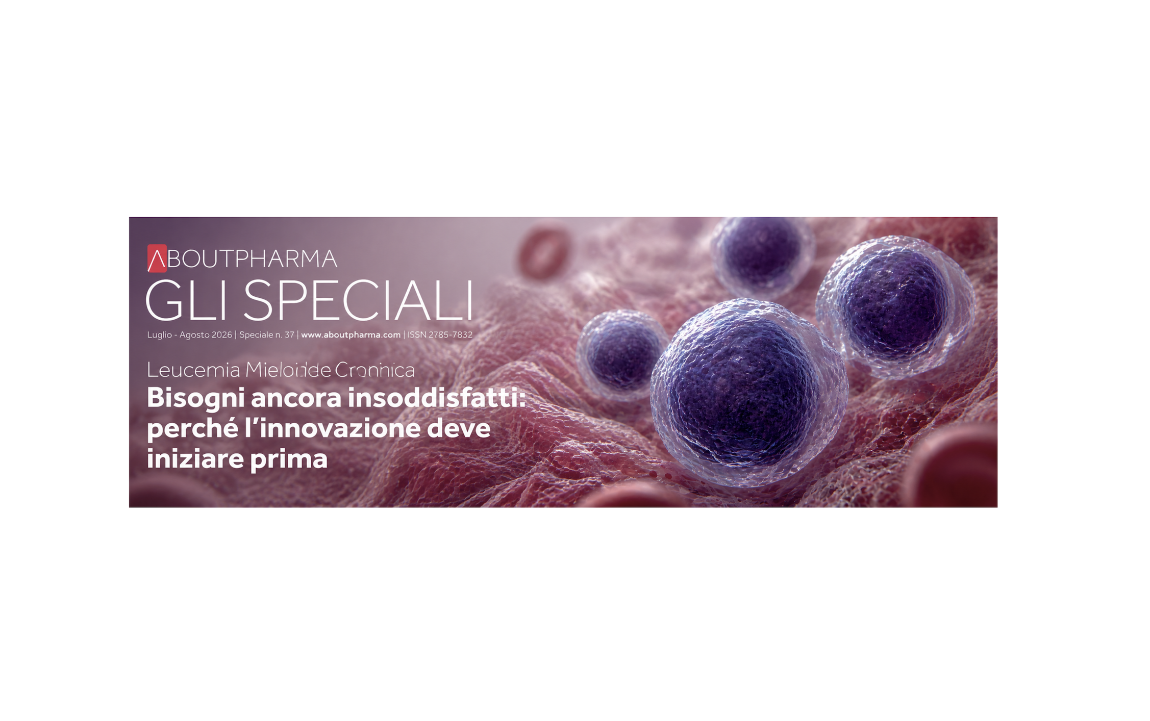 Leucemia mieloide cronica, online lo Speciale di AboutPharma sui bisogni ancora insoddisfatti