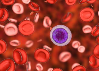 Leucemia pediatrica: verso terapia mirata per sottogruppo con alterazione del gene PAX5