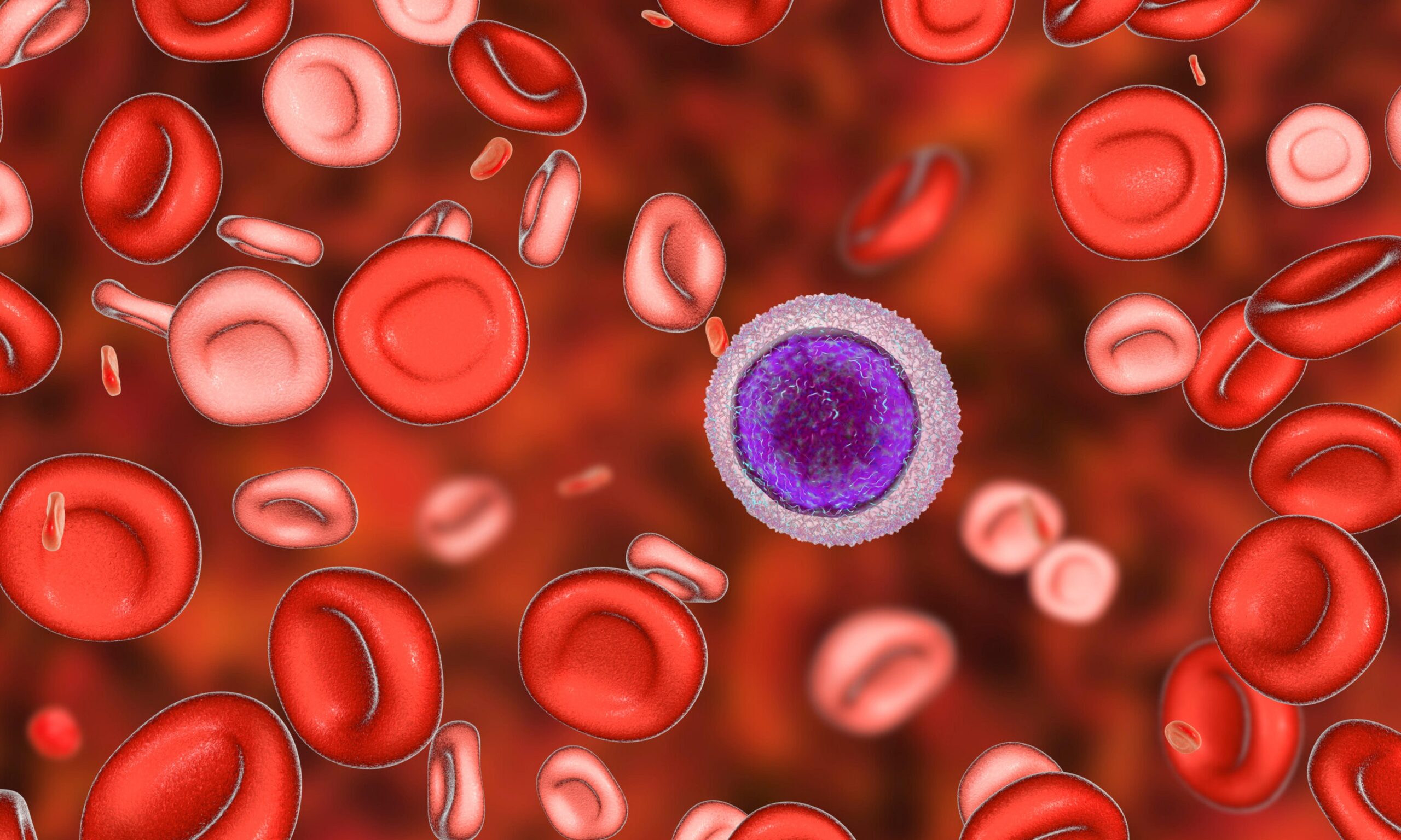 Leucemia pediatrica: verso terapia mirata per sottogruppo con alterazione del gene PAX5