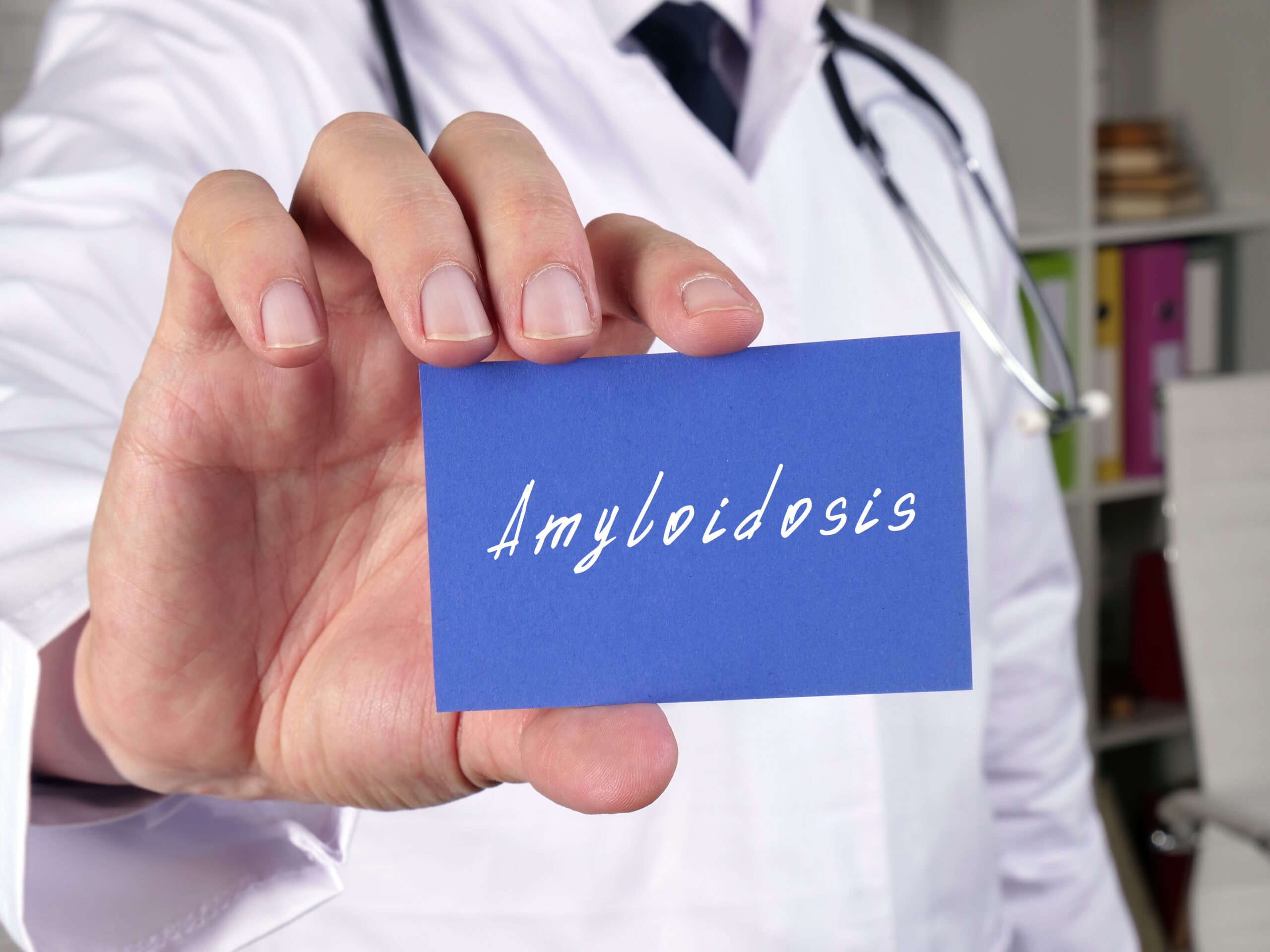 Amiloidosi cardiaca: diagnosi precoce e genetica per cure personalizzate