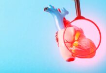 Cardiologia di precisione: terapie antitrombotiche su misura dopo l’infarto