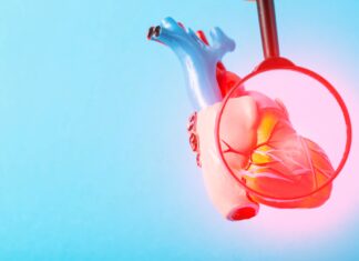 Cardiologia di precisione: terapie antitrombotiche su misura dopo l’infarto