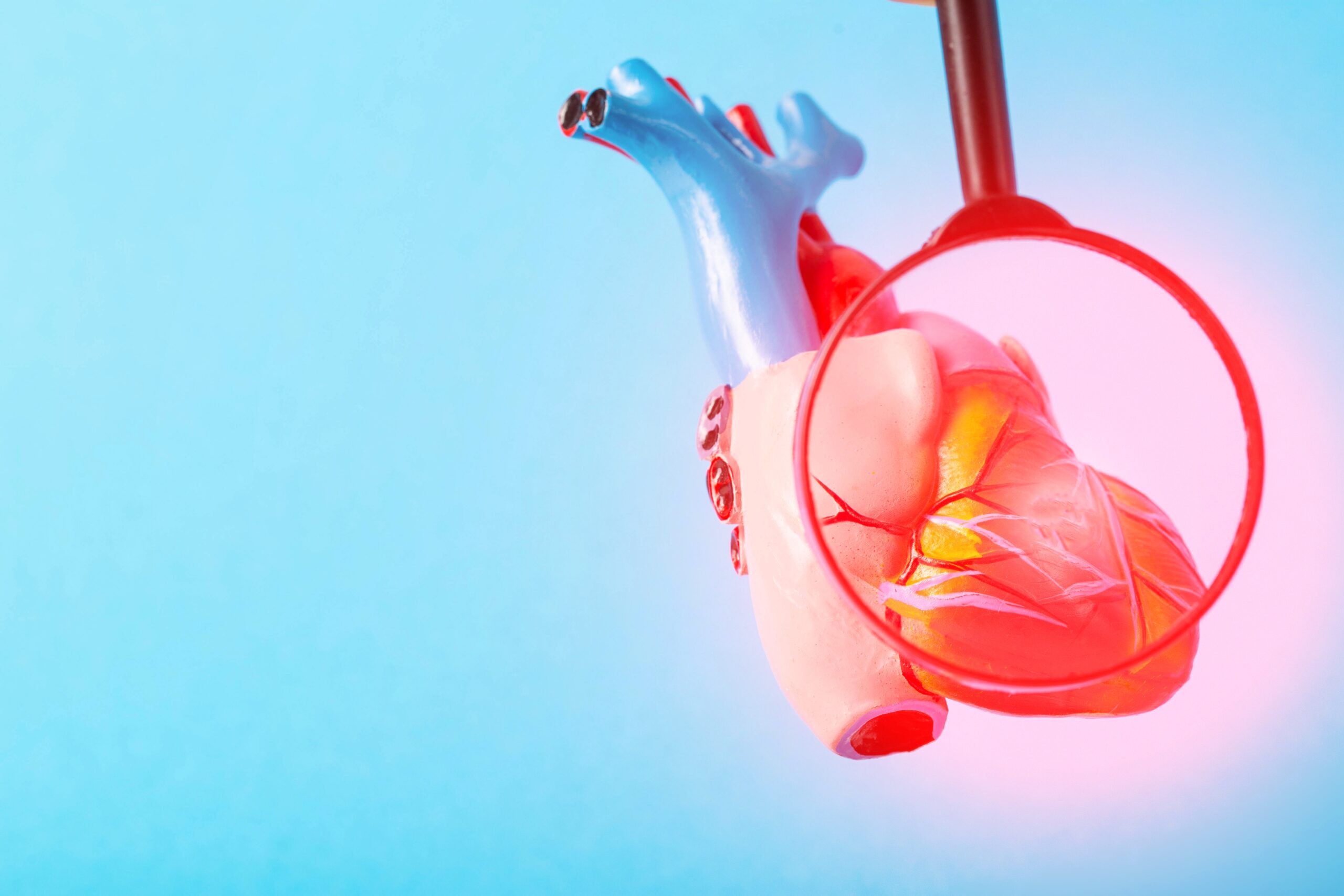 Cardiologia di precisione: terapie antitrombotiche su misura dopo l’infarto