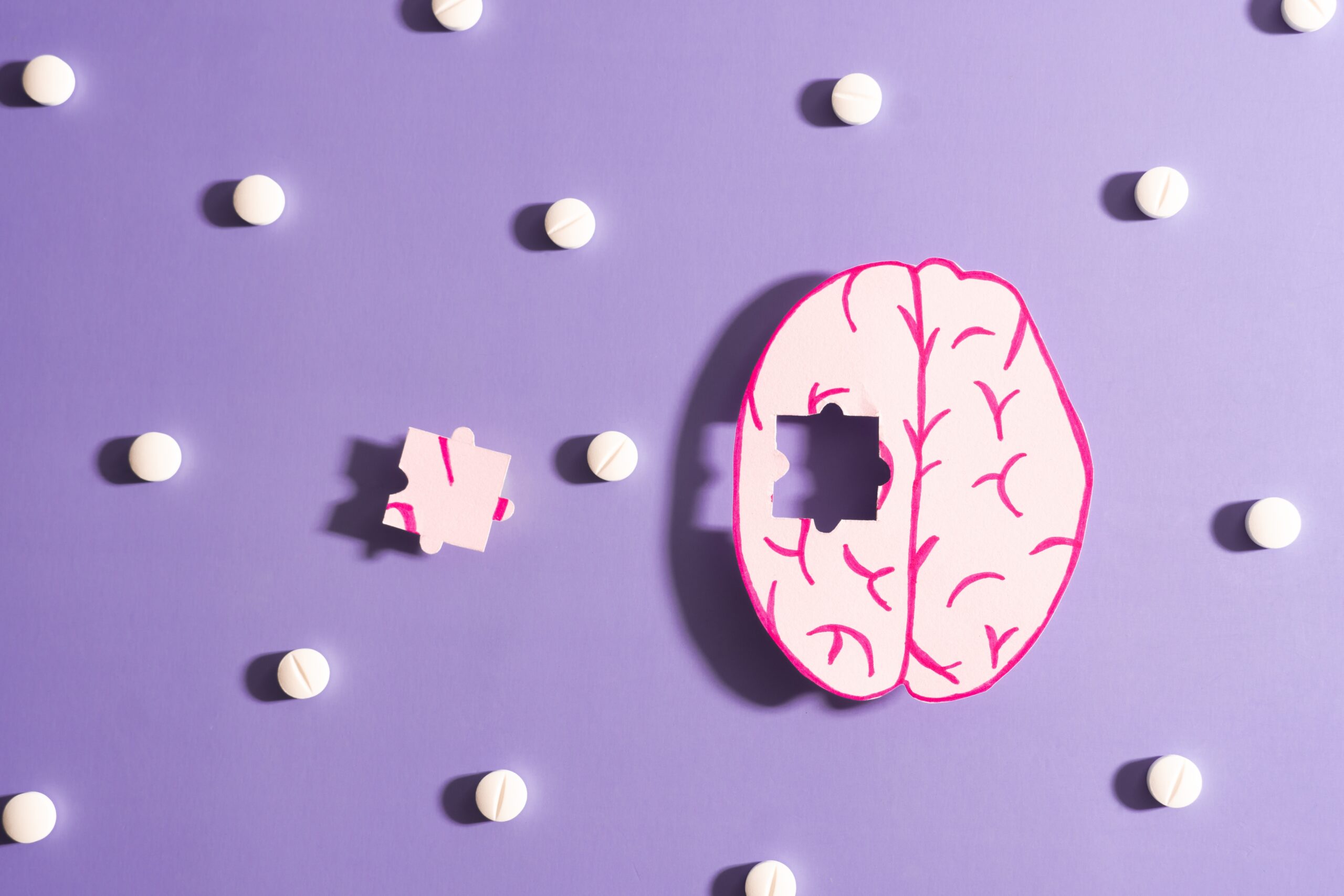 Alzheimer: ricerca clinica, diagnosi precoce e nodo rimborsabilità degli anticorpi anti-amiloide