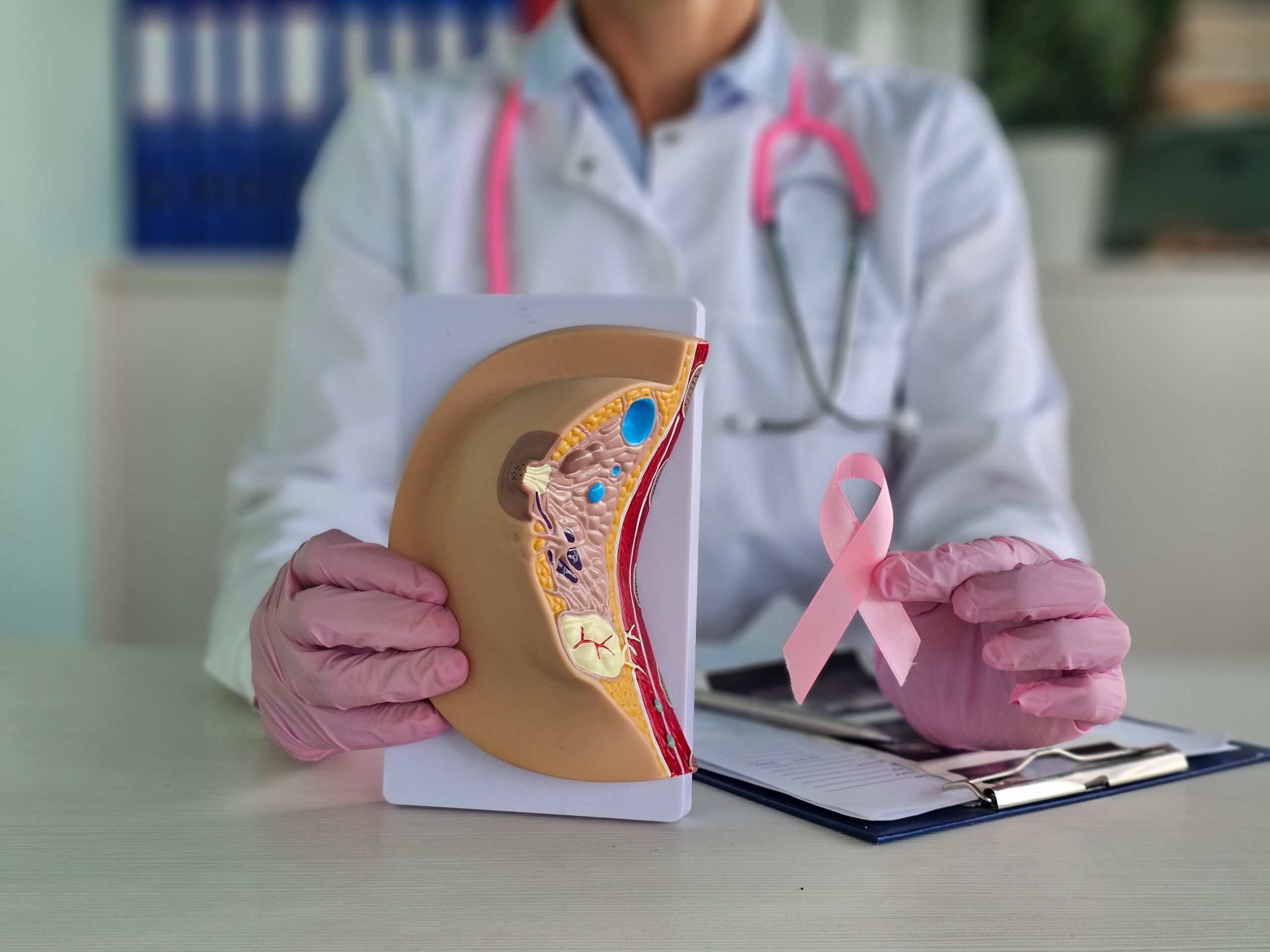 Carcinoma mammario: Aifa approva inavolisib