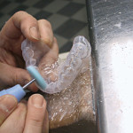 2. Eziopatogenesi e prevenzione delle lesioni traumatiche dento-alveolari