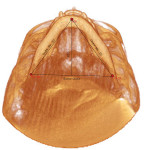 Analisi di parametri lineari, angolari e volumetrici su TC Cone Beam