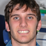 L’uso dei laser Erbium: YAG ed ErbiumCromium: YSGG in odontoiatria restaurativa