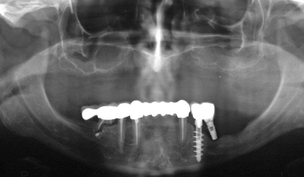 chirurgia-orale-patologie-sistemiche