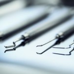 Estetica nei posteriori diretti