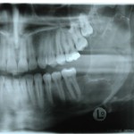 Attuali protocolli nel trattamento del tumore Attuali protocolli nel trattamento del tumore
