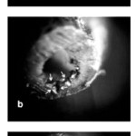 Endodonzia chirurgica retrograda: laser o ultrasuoni?