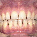 Profili di responsabilità professionale in ortodonzia: errori e complicanze