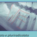 Dal 2D al 3D: un modello parametrico tridimensionale