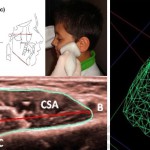 Analisi tridimensionale del muscolo massetere