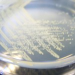 Resistenza agli antibiotici: la soluzione con i batteriofagi Effetti batterici, batteriofagi gengivite parodontite perimplantite