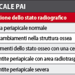 Trattamento endodontico con medicazioni canalari