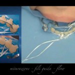 On line quattro video di ortodonzia e odontoiatria pediatrica