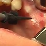 Nella categoria “video” tre filmati di patologia orale