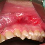 Chirurgia on line in tre video