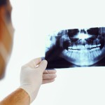 Immagini radiografiche intraorali: effetti sulla distribuzione della dose assorbita