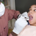 Terapie endodontiche: opportunità dalle cellule staminali