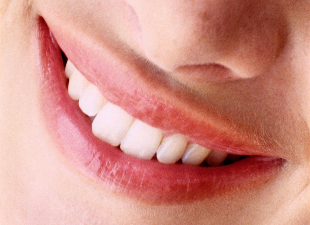 Denti faccette in ceramica_bioceramiche