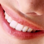 Resistenza alla frattura di faccette in disilicato di litio a livello dei premolari: risultati di uno studio in vitro Denti faccette in ceramica_bioceramiche