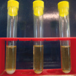 Valutazione della capacità antibatterica di tre sostanze per la medicazione intermedia in endodonzia: test comparativo in vitro