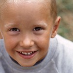 Farmaci antiepilettici orali e lesioni traumatiche oro-facciali in bambini epilettici