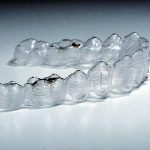 Studio prospettico randomizzato per l’analisi della carica batterica totale sulla superficie di allineatori trasparenti dopo detersione con varie metodiche