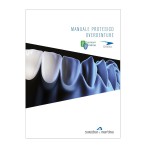 Sweden&Martina: una guida straordinaria per l’Overdenture