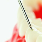 Uomini preistorici: studio sui denti svela nuove abitudini