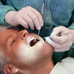 Innesti e sostituti ossei in odontoiatria: quali sono i recenti sviluppi rigenerativa difetti parodontali dentista chirurgia rigenerativa perimplantite seno mascellare innesti ossei impianti