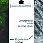 Caratteristiche ed efficacia degli irriganti canalari più utilizzati in Endodonzia