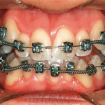 Il Protocollo Easy Damon (PED)