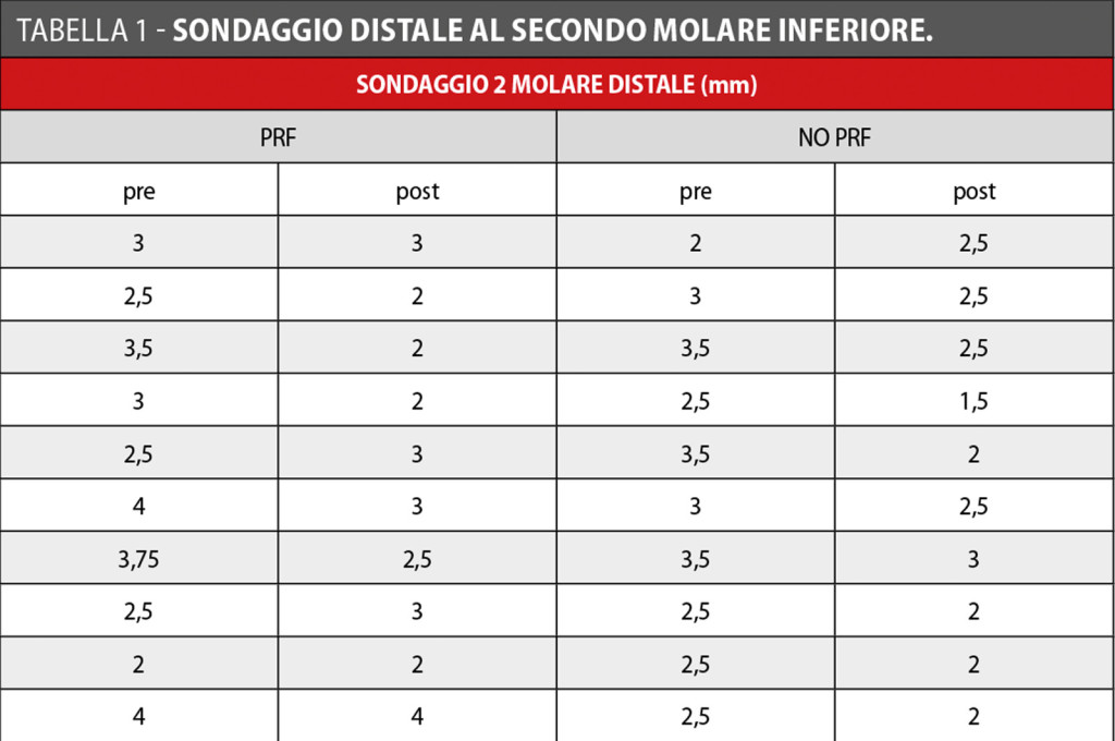 concentrato-di-fibrina-ricca-di-piastrine-prf-avulsione-terzi-molari