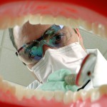 Impianti: introduzione al trattamento della perimplantite impianti perimplantite perimplantitis