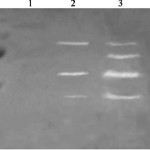 Clorexidina in conservativa: un ausilio per stabilizzare il legame adesivo nel tempo?