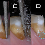 Tips&Tricks Isolamento a finire