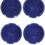 Confronto tra le proprietà antibatteriche di nuove resine composite arricchite con ossido di zinco, acido urosolico e chitosano