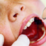 Revisione: formazione del biofilm su materiali restaurativi ed implantari