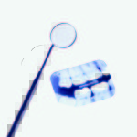 MTA e cemento all’idrossido di calcio nell’incappucciamento diretto