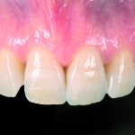 Il nuovo concetto di anatomia ottica