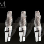 Tecniche chirurgiche preliminari all’inserimento di impianti impianti osteoporosi implantologia a carico immediato impianti