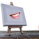 Chiusura di diastema tramite faccette sezionali diastema faccette analisi dentale nuovo sorriso