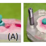 Resistenza meccanica di ponti protesici in materiale polimerico rinforzato con fibre continue di vetro